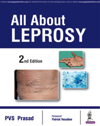 All About Leprosy|2/e