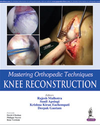 Mastering Orthopedic Techniques: Knee Reconstruction|1/e