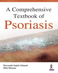 A Comprehensive Textbook of Psoriasis|1/e