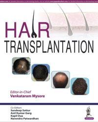 Hair Transplantation|1/e