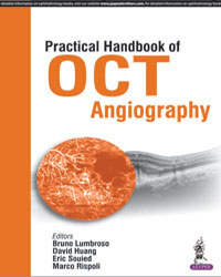 Practical Handbook of OCT Angiography|1/e