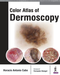 Color Atlas of Dermoscopy|1/e