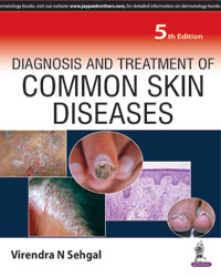 Diagnosis and Treatment of Common Skin Diseases|5/e