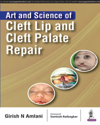 Art and Science of Cleft Lip and Cleft Palate Repair|1/e