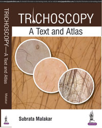 Trichoscopy: A Text and Atlas|1/e