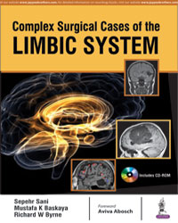 Complex Surgical Cases of the Limbic System|1/e