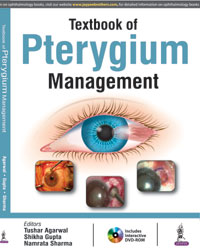 Textbook of Pterygium Management (Includes Interactive DVD-ROM)|1/e