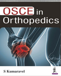 OSCE in Orthopedics|1/e