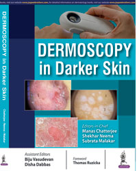 Dermoscopy in Darker Skin|1/e