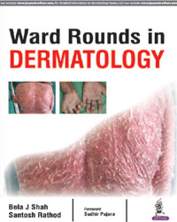 Ward Rounds in Dermatology|1/e