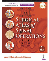 Surgical Atlas of Spinal Operations|2/e