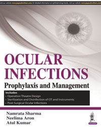 Ocular Infections: Prophylaxis and Management|1/e