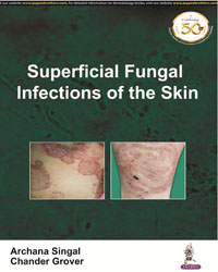 Superficial Fungal Infections of the Skin|1/e