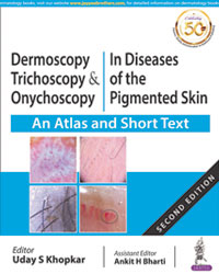 Dermoscopy  Trichoscopy & Onychoscopy in Diseases of the Pigmented Skin (An Atlas and Short Text)|2/e