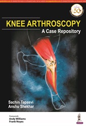 Knee Arthroscopy: A Case Repository|1/e
