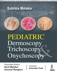 Pediatric Dermoscopy  Trichoscopy & Onychoscopy|1/e