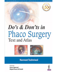 Doâ€™s & Donâ€™ts in Phaco Surgery: Text and Atlas|1/e