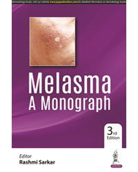 Melasma A Monograph|3/e