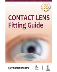 Contact Lens Fitting Guide|2/e
