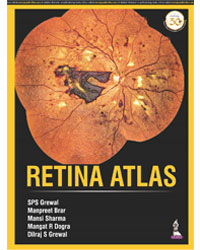 Retina Atlas|1/e