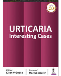 URTICARIA: Interesting Cases|1/e