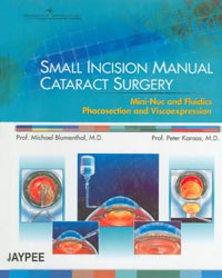 Small Incision Manual Cataract Surgery|1/e