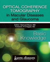 Optical Coherence Tomography in Macular Diseases and Glaucoma - Basic Knowledge|1/e