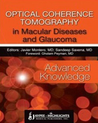 Optical Coherence Tomography in Macular Diseases and Glaucoma: Advanced Knowledge|1/e