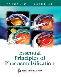 Essential Principles of Phacoemulsification|1/e
