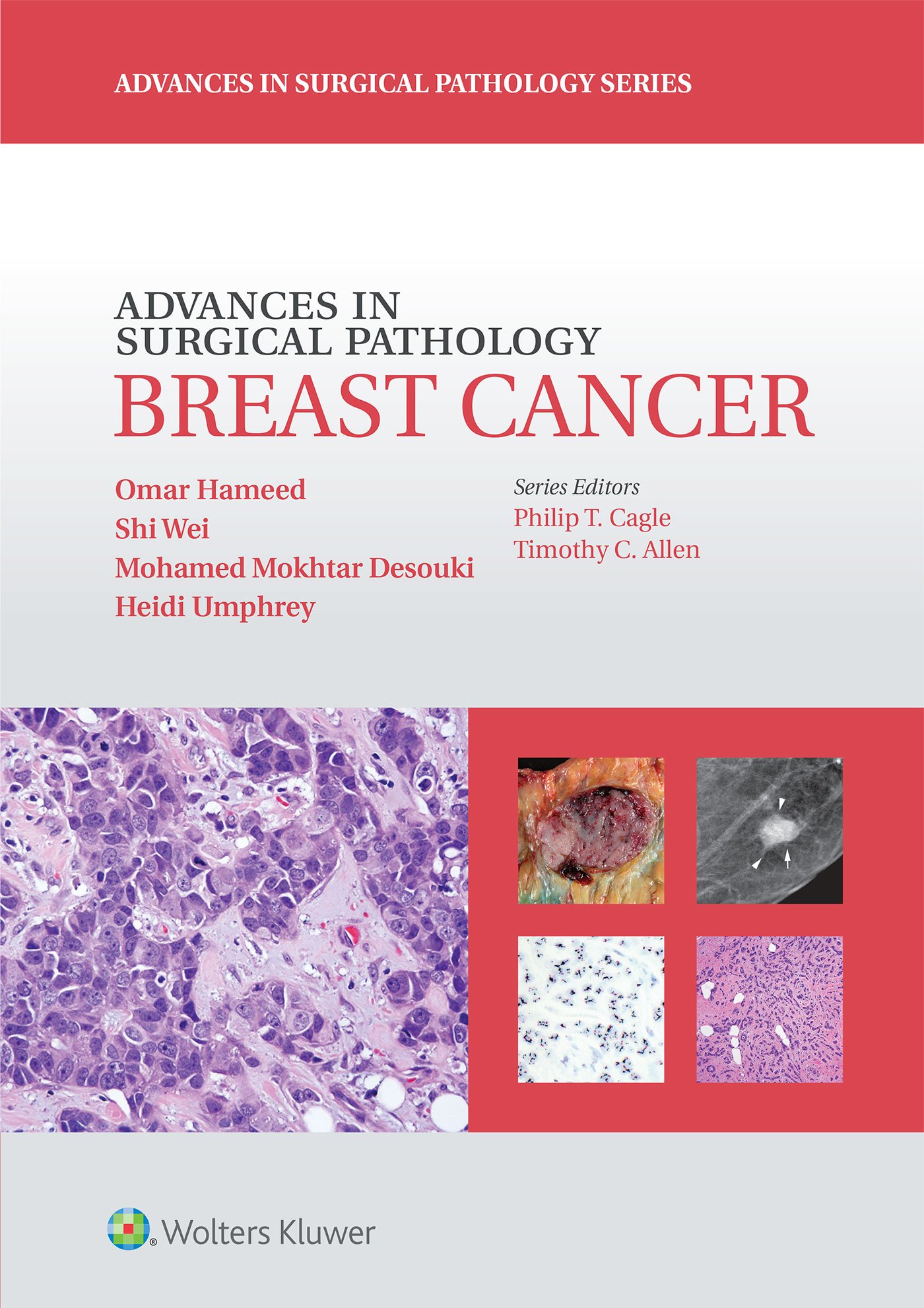 ADVANCES IN SURGICAL PATHOLOGY BREAST CANCER (HB 2015)