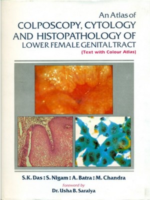An Atlas of Colposcopy Cytology & Histopathology of Lower Female Genital Tract (Text with Colour Atlas) (HB)