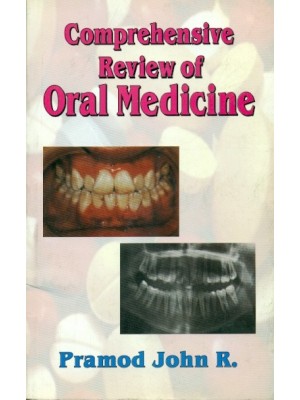 Comprehensive Review of Oral Medicine