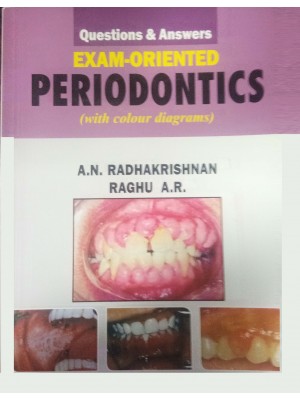 Questions & Answers Exam- Oriented Periodontics (With Colour Diagrams) (PB)
