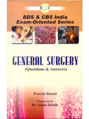 General Surgery: Questions & Answers (PB)