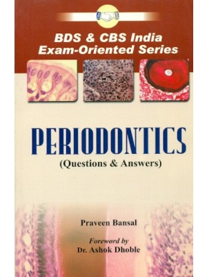 Periodontics: Questions & Answers (PB)