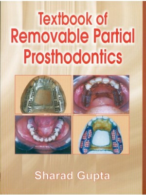 Textbook of Removable Partial Prosthodontics (PB)