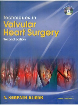 Techniques in Valvular Heart Surgery 2e With DVD (HB)