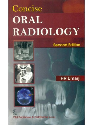 Concise Oral Radiology 2e (PB)