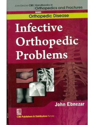 John Ebnezar CBS Handbooks in Orthopedics and Fractures: Orthopedic Disease : Infective Orthopedic Problems