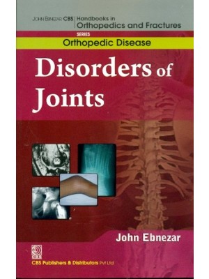 John Ebnezar CBS Handbooks in Orthopedics and Fractures: Orthopedic Disease : Disorders of the Joints