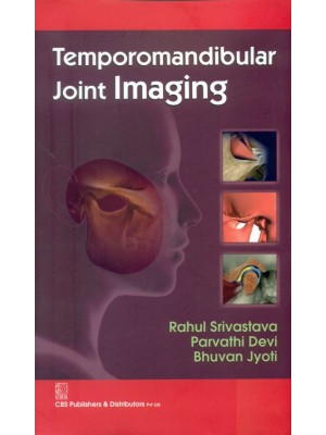 Temporomandibular Joint Imaging (PB)