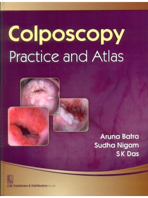 Colposcopy?Practice and Atlas