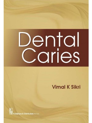 Dental Caries (PB)