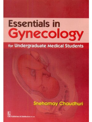 Essentials in Gynecology for Undergraduate Medical Students (PB)