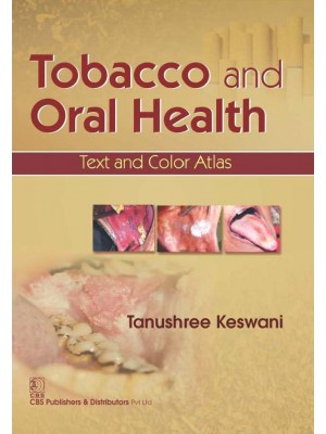 Tobacco and Oral Health: Text and Color Atlas (PB)