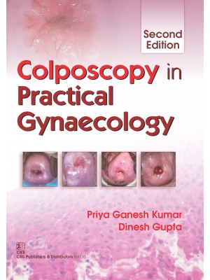 Colposcopy in Practical Gynecology 2e (PB)