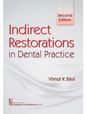Indirect Restorations In Dental Practice 2ed (Pb 2017)