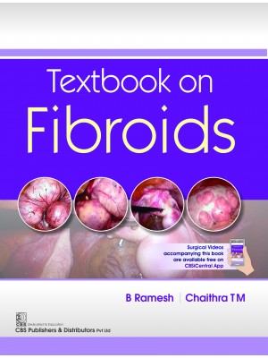 Textbook on Fibroids (PB)