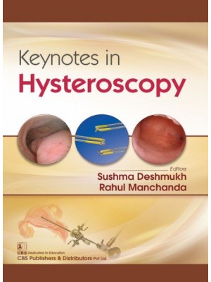 Keynotes in Hysteroscopy (PB)