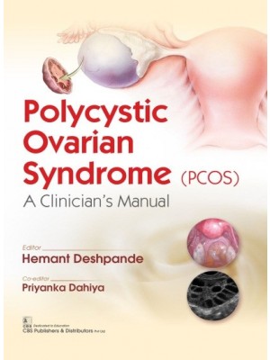 Polycystic Ovarian Syndrome (PCOS): A Clinician's Manual (PB)